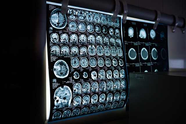 treatment options, medical imaging, interventional radiology, minimally invasive procedures